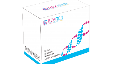 對蝦黃頭病毒（YHV）RNA恒溫核酸檢測試劑盒（不含提?。? />
                            </a>
                        </div>
                                            </div>
                </div>
                <div   id="ozsmw2j"   class="col-lg-5">
                    <div   id="cr35emg"   class="product-intro">
                        <h1 class=